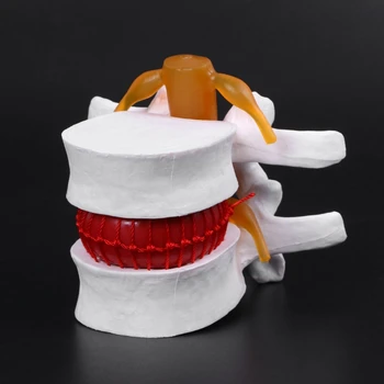 Анатомическая модел херния на лумбалните диск на Човека, Медицински инструмент за изучаване на анатомия