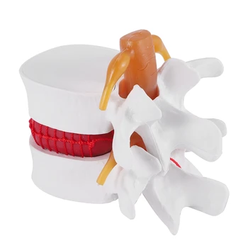 Демонстрационен Модел Херния на Лумбалните диск Човек 1: 1.5 Модел на Лумбалния отдел на гръбначния Стълб За Анатомията на Човека